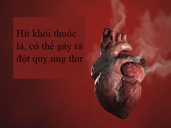 Ảnh bìa bài viết 567737