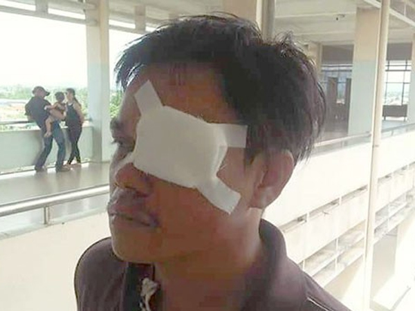 Ảnh bìa bài viết 574505