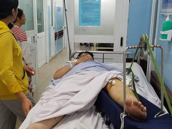 Ảnh bìa bài viết 574840