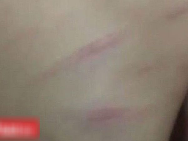 Ảnh bìa bài viết 575855