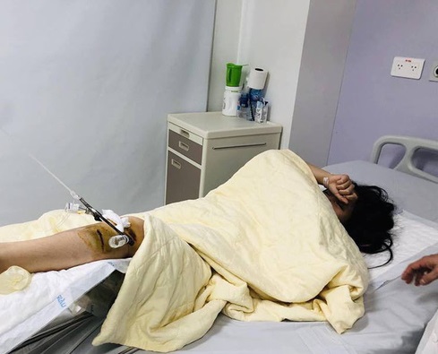 Ảnh bìa bài viết 586496