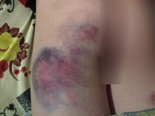 Ảnh bìa bài viết 587614