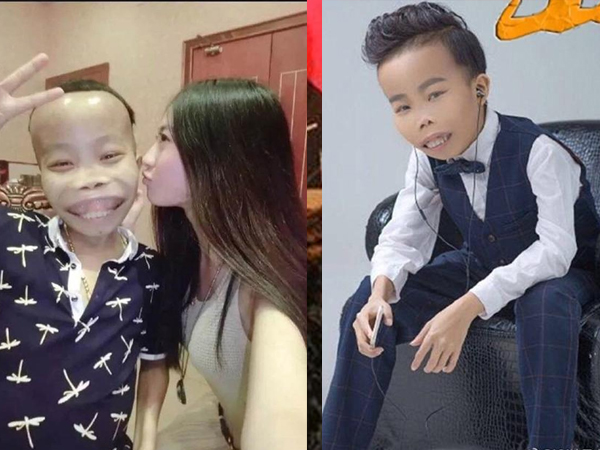 Ảnh bìa bài viết 587806