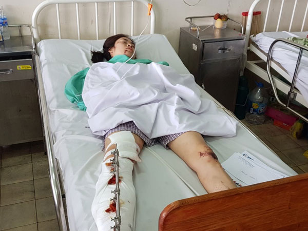 Ảnh bìa bài viết 590587