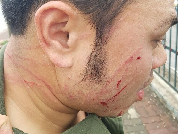 Ảnh bìa bài viết 592655