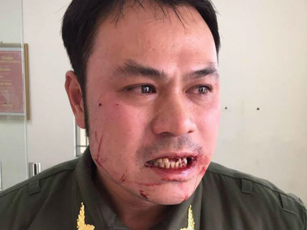 Ảnh bìa bài viết 592795