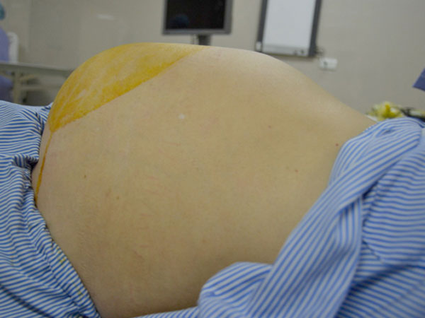 Ảnh bìa bài viết 595945
