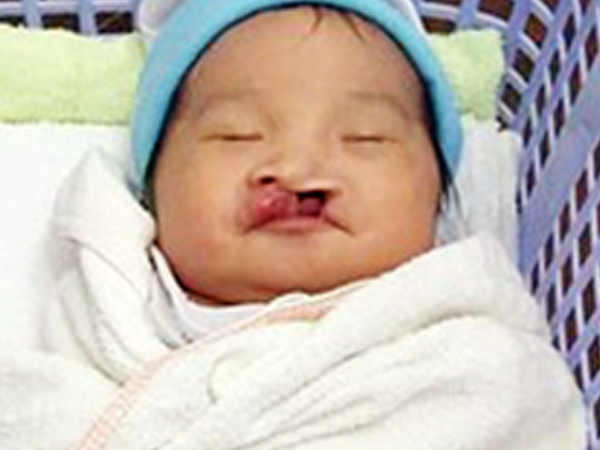 Ảnh bìa bài viết 598270