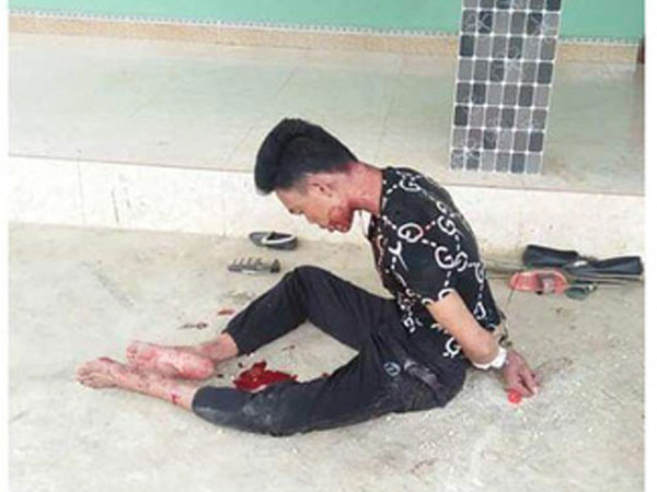 Ảnh bìa bài viết 598845