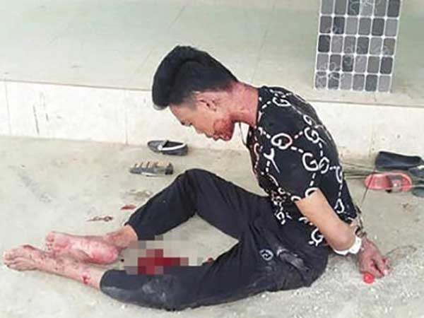 Ảnh bìa bài viết 599020