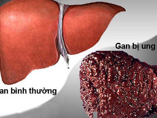 Ảnh bìa bài viết 602266
