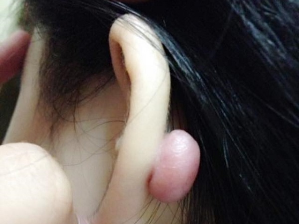 Ảnh bìa bài viết 607585