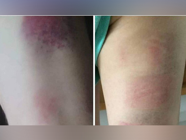 Ảnh bìa bài viết 608967