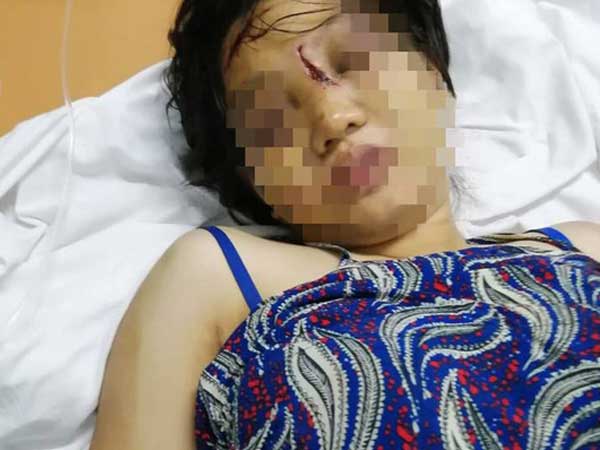 Ảnh bìa bài viết 612354