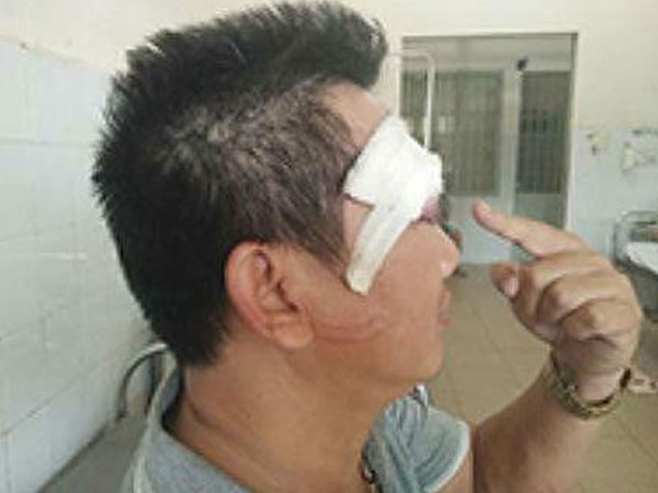 Ảnh bìa bài viết 614718