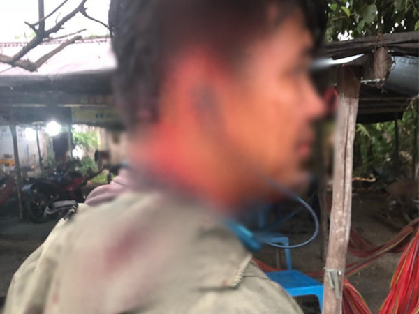 Ảnh bìa bài viết 616082