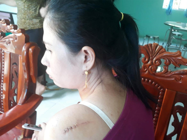 Ảnh bìa bài viết 618970