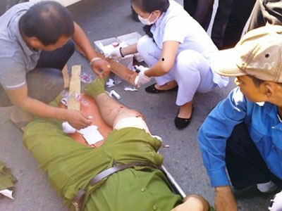 Ảnh bìa bài viết 279799