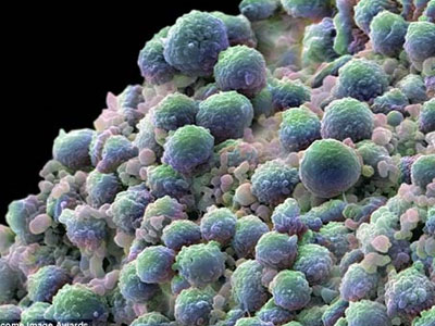 Ảnh bìa bài viết 281678