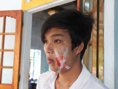 Ảnh bìa bài viết 284475