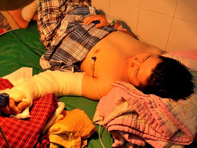 Ảnh bìa bài viết 287204