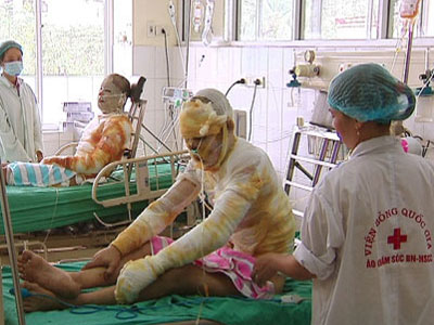 Ảnh bìa bài viết 293609