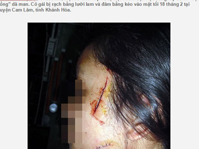 Ảnh bìa bài viết 294548
