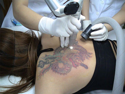 Ảnh bìa bài viết 294909