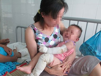 Ảnh bìa bài viết 295886