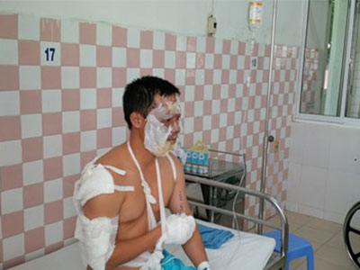 Ảnh bìa bài viết 296489