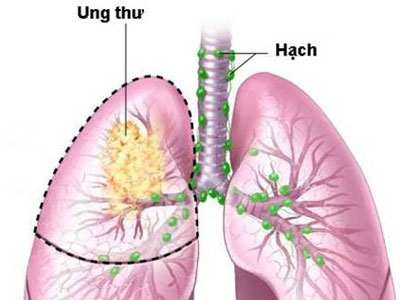 Ảnh bìa bài viết 298183