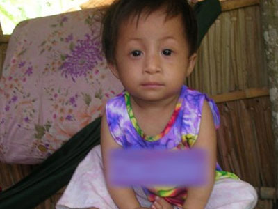 Ảnh bìa bài viết 301089