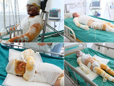 Ảnh bìa bài viết 303210