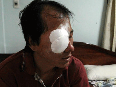 Ảnh bìa bài viết 305220