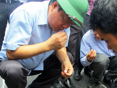 Ảnh bìa bài viết 306623