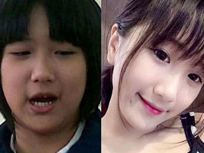 Ảnh bìa bài viết 311598