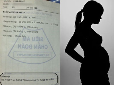 Ảnh bìa bài viết 312133