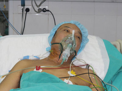 Ảnh bìa bài viết 316314