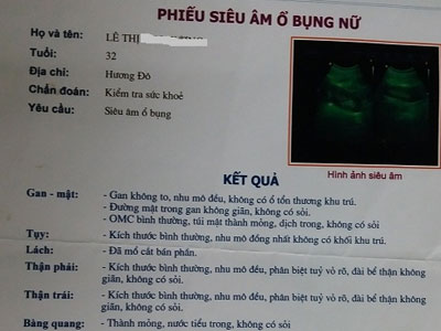 Ảnh bìa bài viết 329855