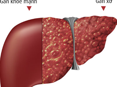 Ảnh bìa bài viết 330784