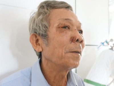 Ảnh bìa bài viết 331760
