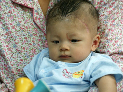 Ảnh bìa bài viết 332233