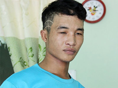Ảnh bìa bài viết 334701