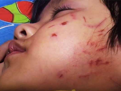 Ảnh bìa bài viết 336948