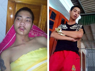 Ảnh bìa bài viết 348043