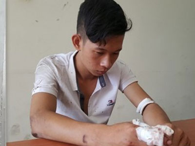 Ảnh bìa bài viết 348107
