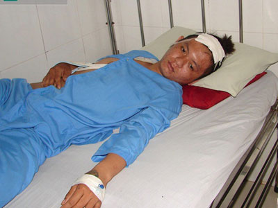 Ảnh bìa bài viết 348383