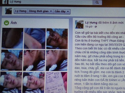 Ảnh bìa bài viết 351539