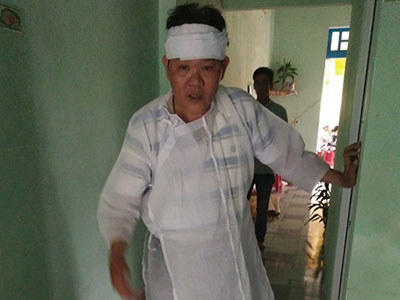 Ảnh bìa bài viết 353012