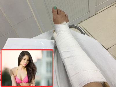 Ảnh bìa bài viết 354589